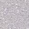 Cadherin Related Family Member 1 antibody, NBP1-92296, Novus Biologicals, Immunohistochemistry frozen image 