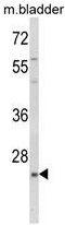 Kruppel Like Factor 16 antibody, GTX80982, GeneTex, Western Blot image 