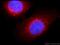 Transferrin Receptor antibody, 66180-1-Ig, Proteintech Group, Immunofluorescence image 