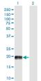 Microtubule Associated Protein 4 antibody, H00004134-M03, Novus Biologicals, Western Blot image 