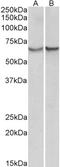 Chloride Intracellular Channel 1 antibody, 43-480, ProSci, Enzyme Linked Immunosorbent Assay image 