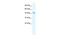 SP140 Nuclear Body Protein Like antibody, PA5-41203, Invitrogen Antibodies, Western Blot image 