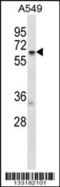 T-Complex 11 Like 2 antibody, 56-962, ProSci, Western Blot image 