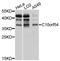 V-Set Immunoregulatory Receptor antibody, STJ113671, St John