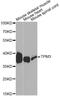 Tropomyosin alpha-3 chain antibody, MBS127255, MyBioSource, Western Blot image 