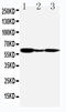 G Protein-Coupled Estrogen Receptor 1 antibody, LS-C313331, Lifespan Biosciences, Western Blot image 