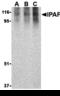 NLR Family CARD Domain Containing 4 antibody, A00525, Boster Biological Technology, Western Blot image 