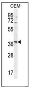 Neurexophilin 4 antibody, AP52980PU-N, Origene, Western Blot image 