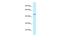 Protein Arginine Methyltransferase 6 antibody, PA5-69069, Invitrogen Antibodies, Western Blot image 