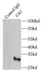 Carbonic Anhydrase 1 antibody, FNab01155, FineTest, Immunoprecipitation image 