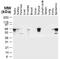 TNF Receptor Associated Factor 6 antibody, NB100-56179, Novus Biologicals, Western Blot image 