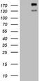 ALK Receptor Tyrosine Kinase antibody, TA801233, Origene, Western Blot image 