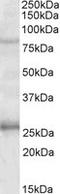 GPRIN Family Member 3 antibody, LS-C139606, Lifespan Biosciences, Western Blot image 