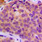 Matrix Metallopeptidase 3 antibody, LS-C352522, Lifespan Biosciences, Immunohistochemistry paraffin image 
