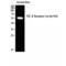 Transforming Growth Factor Beta Receptor 1 antibody, LS-C381773, Lifespan Biosciences, Western Blot image 