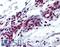 MYB Proto-Oncogene, Transcription Factor antibody, LS-B5315, Lifespan Biosciences, Immunohistochemistry paraffin image 