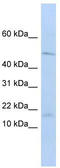 V-Set Pre-B Cell Surrogate Light Chain 1 antibody, TA346454, Origene, Western Blot image 