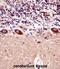 Potassium voltage-gated channel subfamily A member 1 antibody, abx028270, Abbexa, Immunohistochemistry paraffin image 