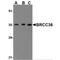 BRCA1/BRCA2-Containing Complex Subunit 3 antibody, MBS150381, MyBioSource, Western Blot image 