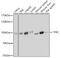 Transferrin Receptor antibody, 19-906, ProSci, Western Blot image 