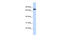 SET1 antibody, 25-188, ProSci, Western Blot image 