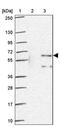 Zinc Finger Protein 34 antibody, PA5-63892, Invitrogen Antibodies, Western Blot image 