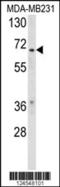 Retinoid X Receptor Beta antibody, 64-104, ProSci, Western Blot image 