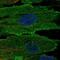 CD248 Molecule antibody, NBP2-14462, Novus Biologicals, Immunofluorescence image 