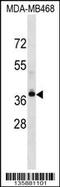 Lysophosphatidic Acid Receptor 4 antibody, 58-648, ProSci, Western Blot image 