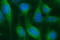 Scavenger Receptor Class B Member 1 antibody, LS-C788495, Lifespan Biosciences, Immunofluorescence image 