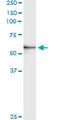 Matrix Metallopeptidase 3 antibody, LS-C197691, Lifespan Biosciences, Immunoprecipitation image 