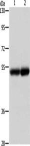 Notch Receptor 4 antibody, CSB-PA446675, Cusabio, Western Blot image 