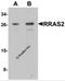 RAS Related 2 antibody, 7249, ProSci, Western Blot image 