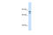 Zinc Finger Protein, FOG Family Member 1 antibody, 28-602, ProSci, Enzyme Linked Immunosorbent Assay image 