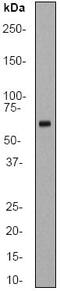 Heterogeneous Nuclear Ribonucleoprotein K antibody, ab52600, Abcam, Western Blot image 