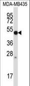 Matrix Metallopeptidase 28 antibody, LS-B10682, Lifespan Biosciences, Western Blot image 