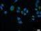 SURF1 Cytochrome C Oxidase Assembly Factor antibody, 15379-1-AP, Proteintech Group, Immunofluorescence image 