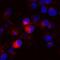 Brevican antibody, AF4009, R&D Systems, Immunocytochemistry image 