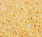 Aryl Hydrocarbon Receptor antibody, LS-C677089, Lifespan Biosciences, Immunohistochemistry paraffin image 