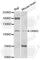 Glutamate Metabotropic Receptor 3 antibody, A2538, ABclonal Technology, Western Blot image 