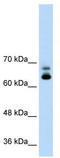 PID antibody, TA332102, Origene, Western Blot image 