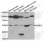 Pyruvate Dehyrogenase Phosphatase Catalytic Subunit 1 antibody, A6332, ABclonal Technology, Western Blot image 