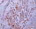 Secreted Phosphoprotein 1 antibody, A-0412-100, Epigentek, Immunohistochemistry paraffin image 