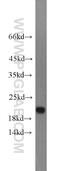 Cysteine Dioxygenase Type 1 antibody, 12589-1-AP, Proteintech Group, Western Blot image 