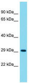 Syntaxin 8 antibody, TA343114, Origene, Western Blot image 