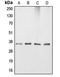 Apolipoprotein E antibody, LS-C351846, Lifespan Biosciences, Western Blot image 