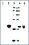 Cytochrome P450 Family 11 Subfamily A Member 1 antibody, NBP1-85368, Novus Biologicals, Western Blot image 
