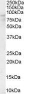 Oxysterol-binding protein 1 antibody, PA5-18364, Invitrogen Antibodies, Western Blot image 