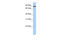 Transmembrane Protein 63A antibody, 25-646, ProSci, Western Blot image 