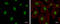 Cullin 4B antibody, GTX129298, GeneTex, Immunocytochemistry image 